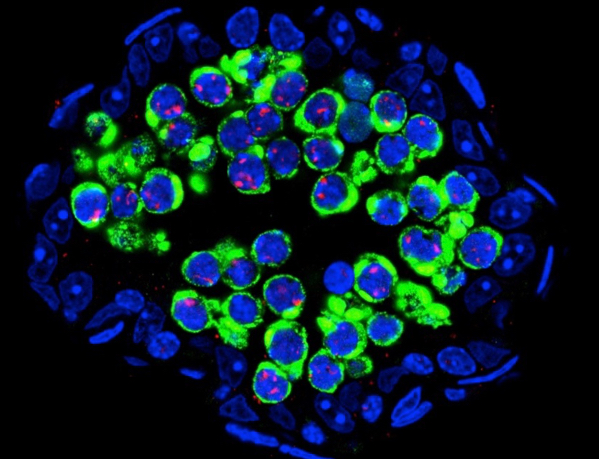 Tubule