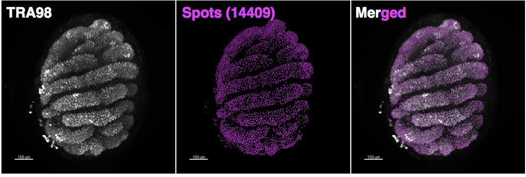 WM Testis